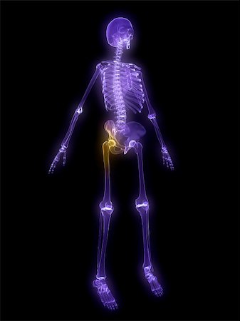 simsearch:400-04191663,k - 3d rendered anatomy illustration of a painful human hip Photographie de stock - Aubaine LD & Abonnement, Code: 400-04081641