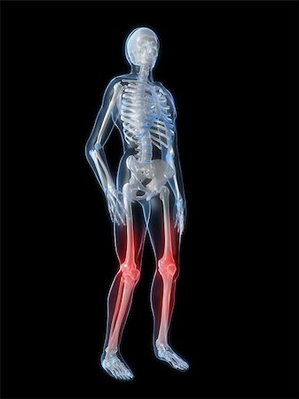 simsearch:400-04163427,k - 3d rendered illustration of a human skeleton with highlighted knees Stockbilder - Microstock & Abonnement, Bildnummer: 400-04103523