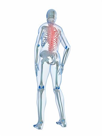 simsearch:400-04191663,k - 3d rendered illustration of a human skeleton with painful back Photographie de stock - Aubaine LD & Abonnement, Code: 400-04103545