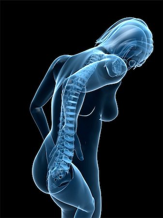 simsearch:400-04191663,k - 3d rendered illustration of a transparent female body with backache Photographie de stock - Aubaine LD & Abonnement, Code: 400-04103556