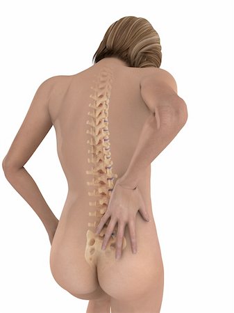 3d rendered illustration of a female body with backache Stock Photo - Budget Royalty-Free & Subscription, Code: 400-04103599