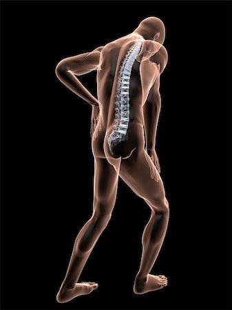 simsearch:400-04191663,k - 3d rendered illustration of a transparent male body with backache Photographie de stock - Aubaine LD & Abonnement, Code: 400-04103624