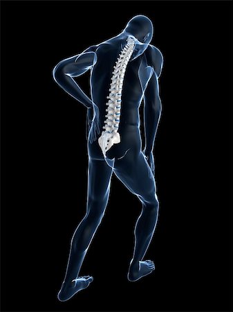 simsearch:400-04191660,k - 3d rendered illustration of a transparent male body with backache Stock Photo - Budget Royalty-Free & Subscription, Code: 400-04103627