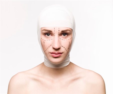 facelift bandage - Woman prepared for a plastic surgery Stock Photo - Budget Royalty-Free & Subscription, Code: 400-04117254