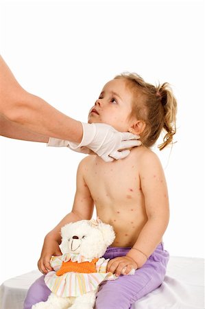 Little girl with contagious disease at the doctors checkup - healthcare concept, isolated Stock Photo - Budget Royalty-Free & Subscription, Code: 400-04136487