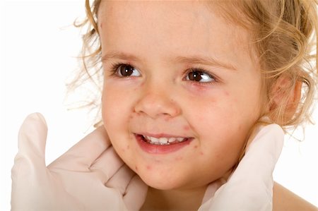 rubber nurse - Little girl with small pox at the doctors checkup - isolated, closeup Stock Photo - Budget Royalty-Free & Subscription, Code: 400-04136493