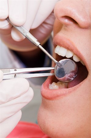 young woman visiting dentist for dental inspection Stock Photo - Budget Royalty-Free & Subscription, Code: 400-04144444