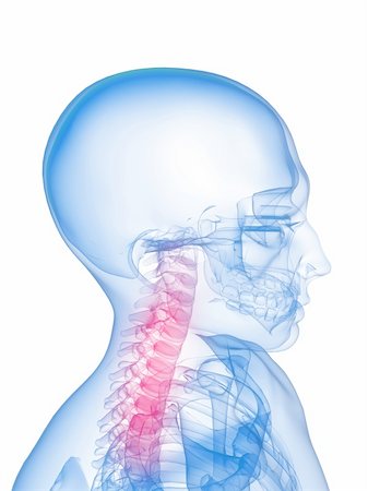 simsearch:400-04008303,k - 3d rendered x-ray illustration of a human skeleton with highlighted neck Stockbilder - Microstock & Abonnement, Bildnummer: 400-04154405