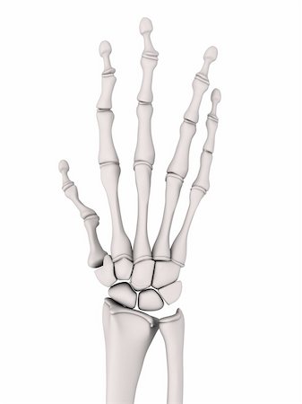 rheumatoid arthritis - 3d rendered x-ray illustration of a skeletal hand with arthritis Stock Photo - Budget Royalty-Free & Subscription, Code: 400-04157160