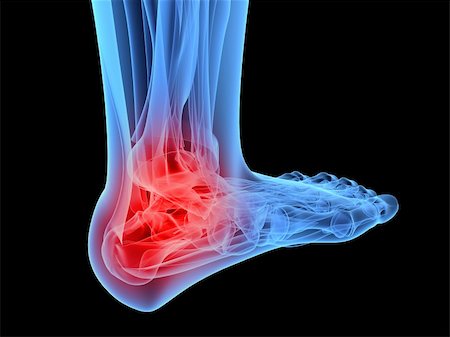 entzündung - 3d rendered x-ray illustration of a human skeletal foot with highlighted ankle Stockbilder - Microstock & Abonnement, Bildnummer: 400-04157161