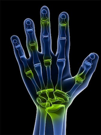 simsearch:400-04164497,k - 3d rendered x-ray illustration of a hand with highlighted joints Stock Photo - Budget Royalty-Free & Subscription, Code: 400-04164424