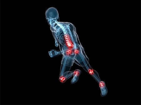simsearch:700-00150546,k - 3d rendered x-ray illustration of a running skeleton with highlighted joints Stock Photo - Budget Royalty-Free & Subscription, Code: 400-04164563