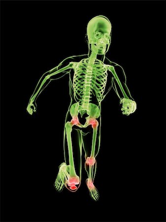 simsearch:400-04683335,k - 3d rendered x-ray illustration of a running skeleton with highlighted joints Stock Photo - Budget Royalty-Free & Subscription, Code: 400-04166395