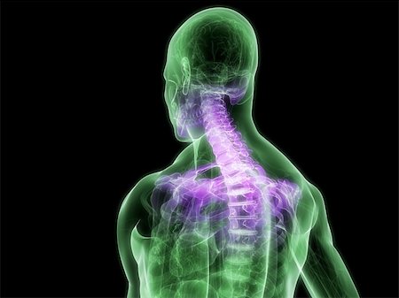 simsearch:400-04481005,k - 3d rendered illustration of a human skeletal back with highlighted neck Stock Photo - Budget Royalty-Free & Subscription, Code: 400-04166415