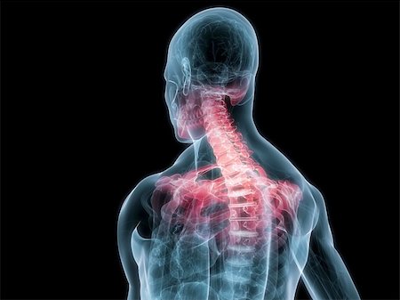 simsearch:400-04163427,k - 3d rendered illustration of a human skeletal back with highlighted neck Stock Photo - Budget Royalty-Free & Subscription, Code: 400-04166416