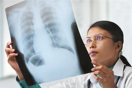 Female doctor checking xray image. focus on the xray image (with some grain or noise from it) Fotografie stock - Microstock e Abbonamento, Codice: 400-04163275