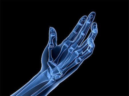rheumatoid arthritis - 3d rendered x-ray illustration of human skeletal hand Stock Photo - Budget Royalty-Free & Subscription, Code: 400-04163621