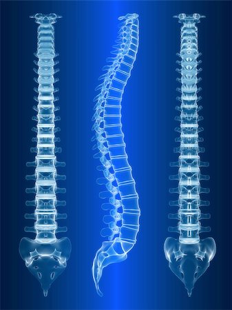 simsearch:400-04311636,k - 3d rendered illustration of different views of a spine Foto de stock - Royalty-Free Super Valor e Assinatura, Número: 400-04176821