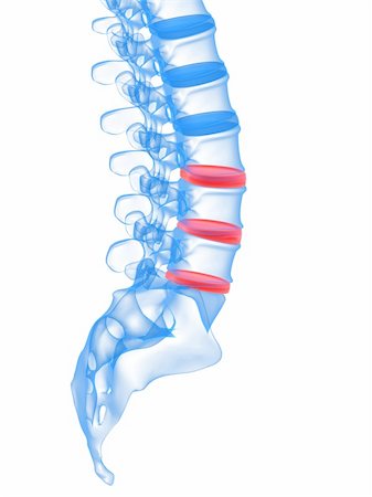 3d rendered illustration of highlighted discs in human spine Stock Photo - Budget Royalty-Free & Subscription, Code: 400-04178748