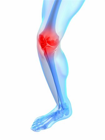 simsearch:400-04191634,k - 3d rendered illustration of a skeletal knee with painful joint Foto de stock - Royalty-Free Super Valor e Assinatura, Número: 400-04189653