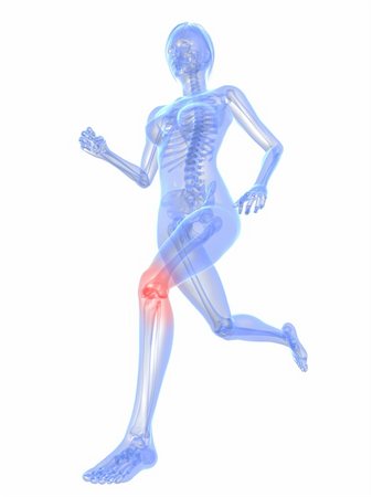 simsearch:400-04683335,k - 3d rendered illustration of a running skeleton with highlighted knee Stock Photo - Budget Royalty-Free & Subscription, Code: 400-04189769