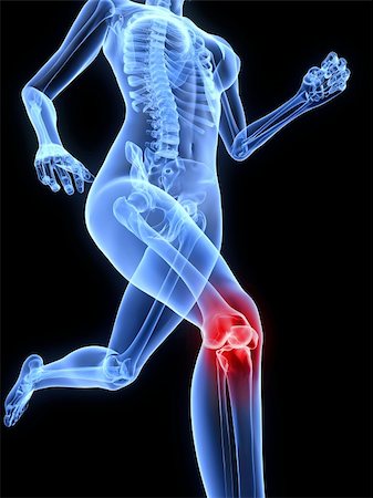 3d rendered illustration of a running skeleton with highlighted knee Stock Photo - Budget Royalty-Free & Subscription, Code: 400-04189782