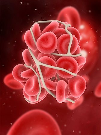 simsearch:400-04189840,k - 3d rendered illustration of a blood clot in an artery Foto de stock - Super Valor sin royalties y Suscripción, Código: 400-04189840