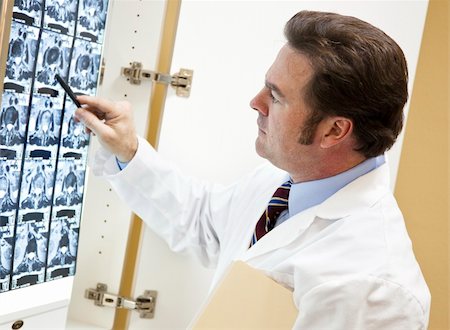 Chiropractor examines a CT scan of a patient's spine. Photographie de stock - Aubaine LD & Abonnement, Code: 400-04199862