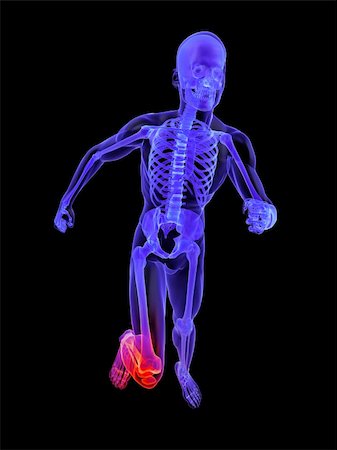 simsearch:400-07088080,k - 3d rendered illustration of a running skeleton with highlighted knee Stock Photo - Budget Royalty-Free & Subscription, Code: 400-04191175