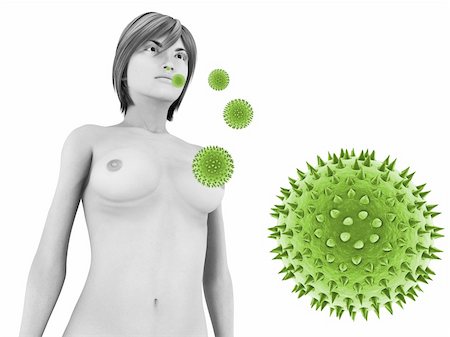 3d rendered illustration of pollen attacking woman Stock Photo - Budget Royalty-Free & Subscription, Code: 400-04191232