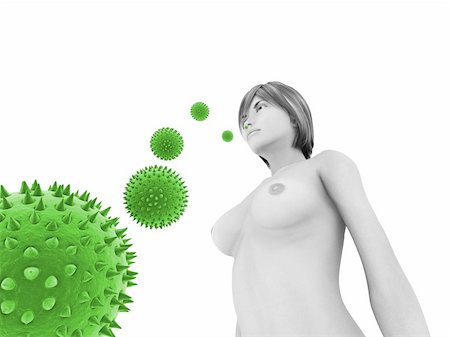 pneumoniae - 3d rendered illustration of pollen attacking woman Stock Photo - Budget Royalty-Free & Subscription, Code: 400-04191240