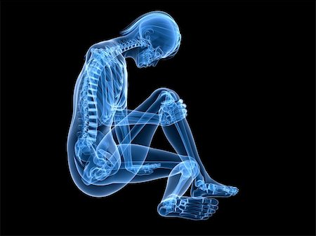 simsearch:400-04191634,k - 3d rendered illustration of a sitting female skeleton with painful knee Foto de stock - Royalty-Free Super Valor e Assinatura, Número: 400-04191403