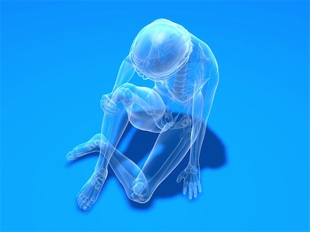 simsearch:400-04191634,k - 3d rendered illustration of a sitting female skeleton with painful knee Foto de stock - Royalty-Free Super Valor e Assinatura, Número: 400-04191414