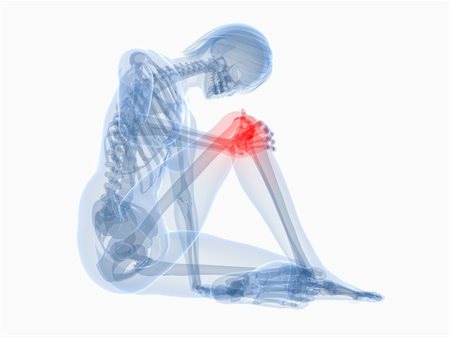simsearch:400-04191634,k - 3d rendered illustration of a sitting female skeleton with highlighted knee Foto de stock - Royalty-Free Super Valor e Assinatura, Número: 400-04191411