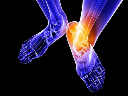 3d rendered illustration of a skeletal foot with highlighted ankle Stock Photo - Budget Royalty-Free & Subscription, Code: 400-04191675