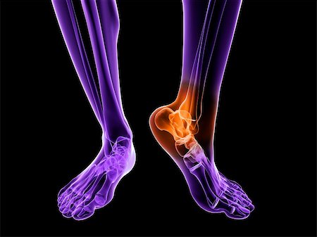 3d rendered illustration of a skeletal foot with highlighted ankle Stock Photo - Budget Royalty-Free & Subscription, Code: 400-04191679