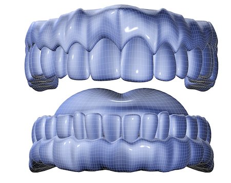 doctor checkup models pictures - 3d image of mesh denture isolated in white Stock Photo - Budget Royalty-Free & Subscription, Code: 400-04260654