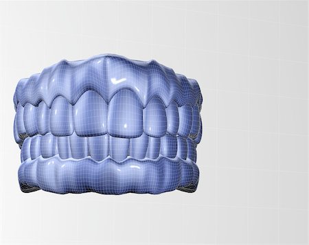 dental technician - 3d image of mesh denture isolated in white Stock Photo - Budget Royalty-Free & Subscription, Code: 400-04260653