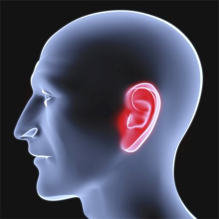 head of a man under the X-rays. ear is highlighted in red. Stock Photo - Budget Royalty-Free & Subscription, Code: 400-04272881