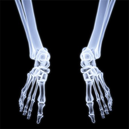 human legs under X-rays. 3d image. Stock Photo - Budget Royalty-Free & Subscription, Code: 400-04272896