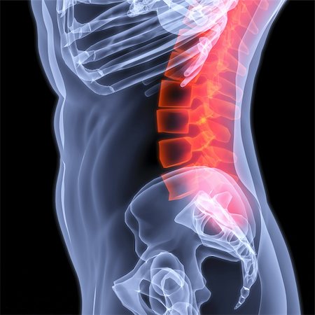 simsearch:400-04003518,k - Male torso under X-rays. The spine is highlighted in red. Fotografie stock - Microstock e Abbonamento, Codice: 400-04272931