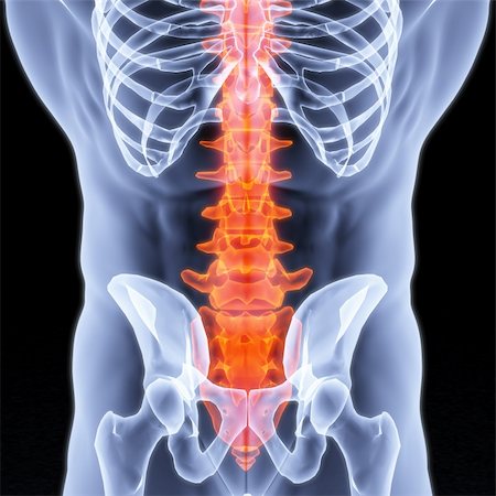 Male torso under X-rays. The spine is highlighted in red. Stock Photo - Budget Royalty-Free & Subscription, Code: 400-04272932