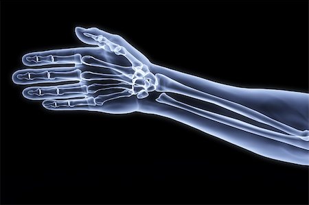 simsearch:400-05715953,k - human hand under the X-rays. Stock Photo - Budget Royalty-Free & Subscription, Code: 400-04272968