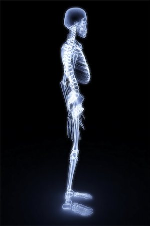simsearch:400-04391285,k - human skeleton under the X-rays. 3d render Photographie de stock - Aubaine LD & Abonnement, Code: 400-04273058