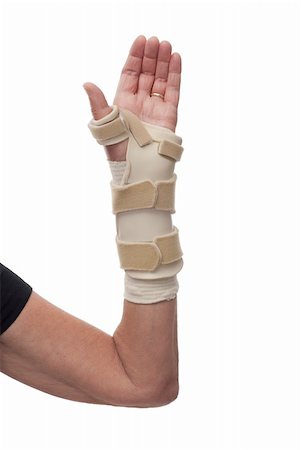 simsearch:400-04788265,k - Bandage and long splint on woman's hand and arm after injury or surgery.Isolated on white. Foto de stock - Royalty-Free Super Valor e Assinatura, Número: 400-04284569