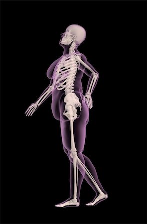 simsearch:400-06568234,k - 3D render of an overweight female medical skeleton with back pain Stock Photo - Budget Royalty-Free & Subscription, Code: 400-04280624