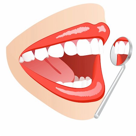 white teeth mouth with dental mirror Stock Photo - Budget Royalty-Free & Subscription, Code: 400-04306085
