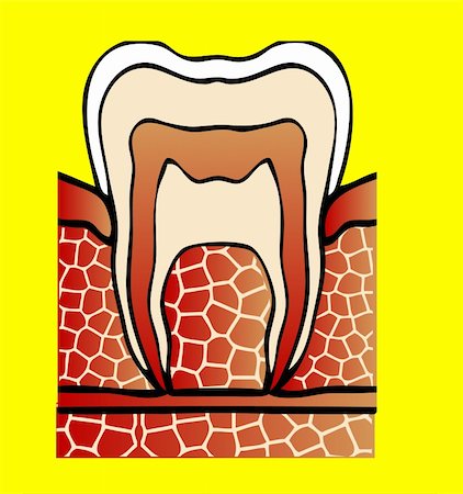 simsearch:400-06108956,k - symptoms dental cavity vector illustration Fotografie stock - Microstock e Abbonamento, Codice: 400-04320324