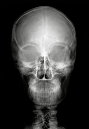 suljo (artist) - Human head on black and white x-ray film Foto de stock - Royalty-Free Super Valor e Assinatura, Número: 400-04322795