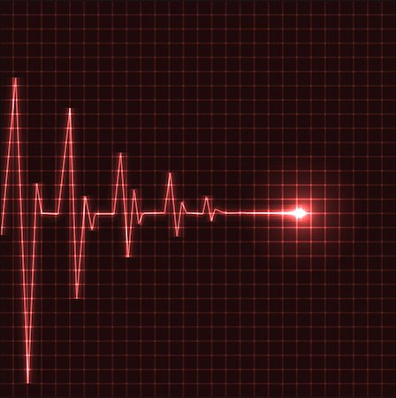 electrocardiogram - Abstract heart beats cardiogram illustration - vector Stock Photo - Budget Royalty-Free & Subscription, Code: 400-04406297